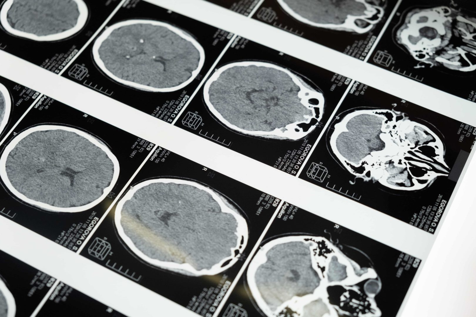 Neuromarketing - czym jest i dlaczego warto się nim zainteresować